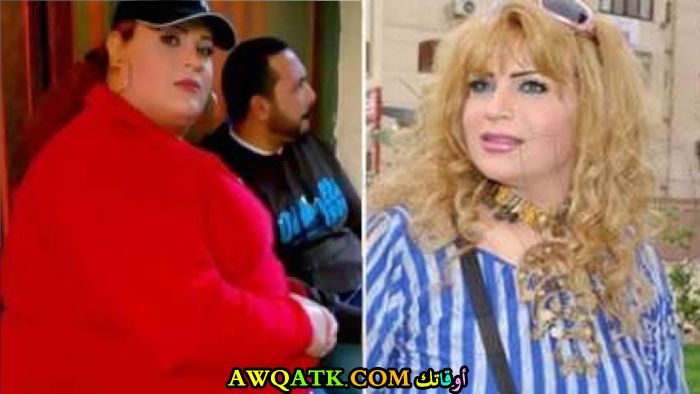 صورة للفنانة نورا السباعي قبل و بعد التخسيس