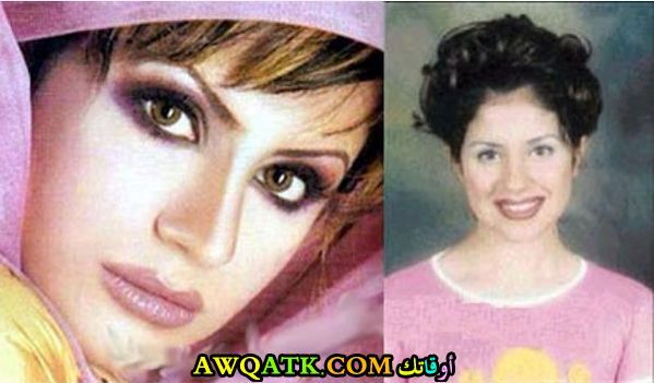 حليمة بولند قبل التجميل