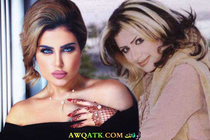 حليمة بولند قبل وبعد عمليات التجميل